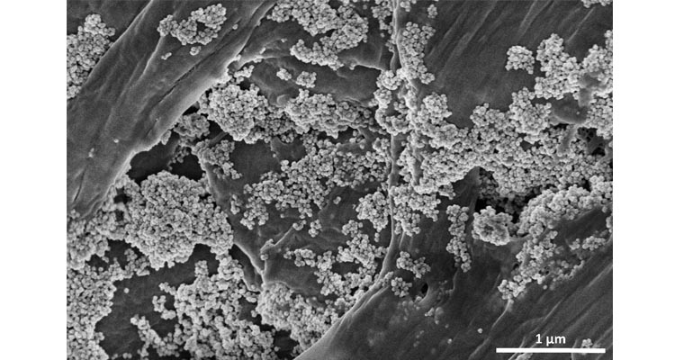 Investigadores del CSIC consiguen eliminar microplásticos del agua con nanoflores de óxido de hierro